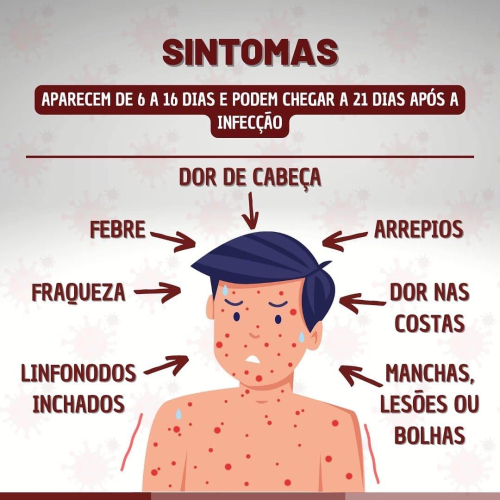 Tudo o que você precisa saber sobre Monkeypox.